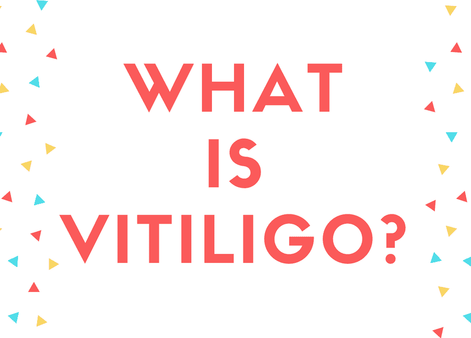 What is Vitiligo?